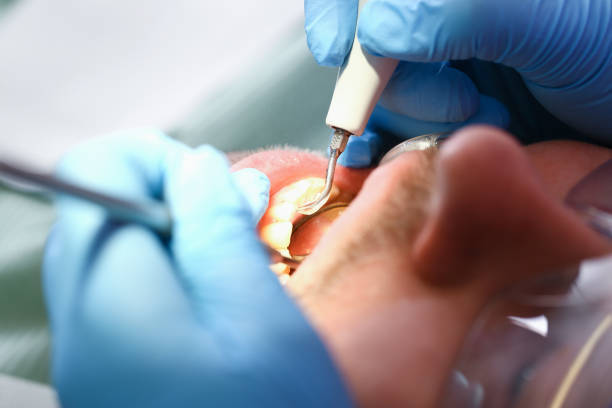 Best Emergency Dental Care for Broken or Chipped Teeth in Coldspring, TX