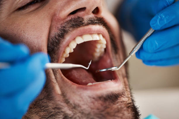 Best Urgent Care for Lost Fillings or Crowns in Coldspring, TX